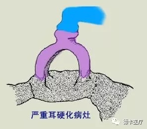 4.webp.jpg